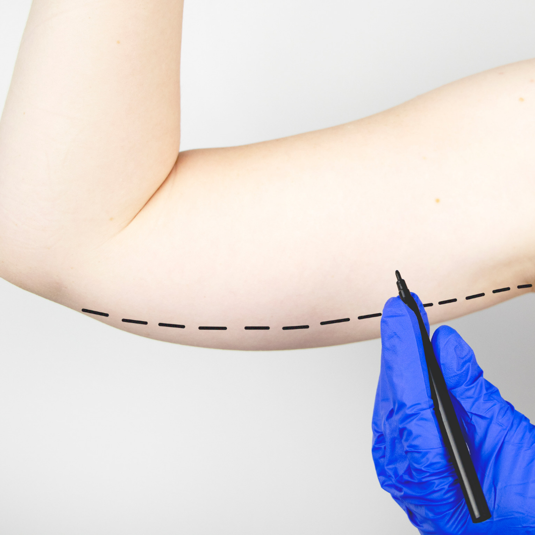 skintightening skintightening